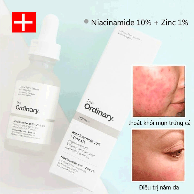Serum dưỡng da mặt Niacinamide 10% + kẽm 1% Tinh chất 30ml The Ordinary Làm sáng màu da nhanh chóng Thu nhỏ lỗ chân lông Loại bỏ nám và tàn nhang serum dưỡng da trị mụn