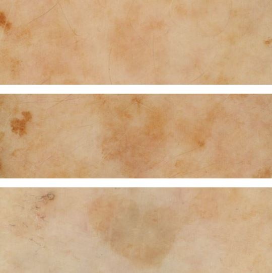Eucerin WHITE THERAPY visibly reduces dark spots over 12 weeks.