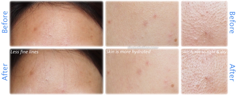 lotion mask before and after